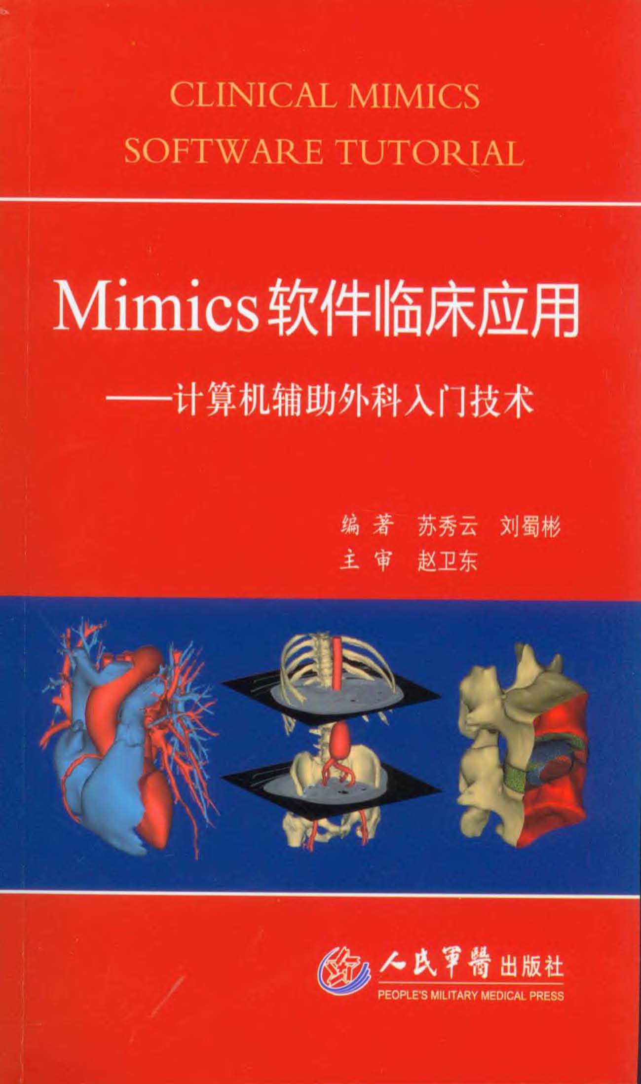 Mimics软件临床应用—