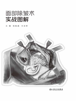 面部除皱术实战图解