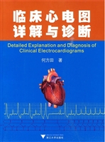 临床心电图详解与诊断