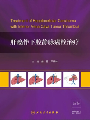 肝癌伴下腔静脉癌栓治