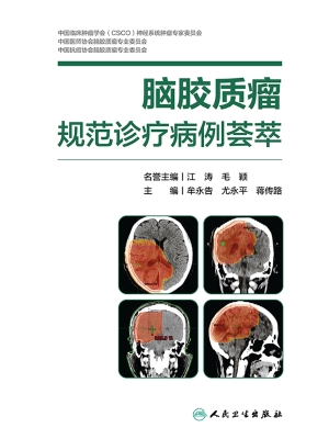 脑胶质瘤规范诊疗病例