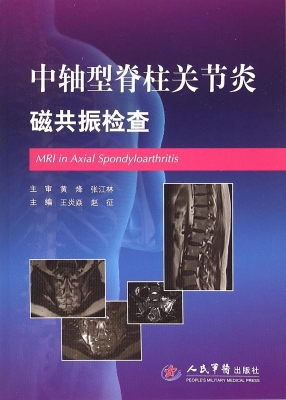 中轴型脊柱关节炎磁共