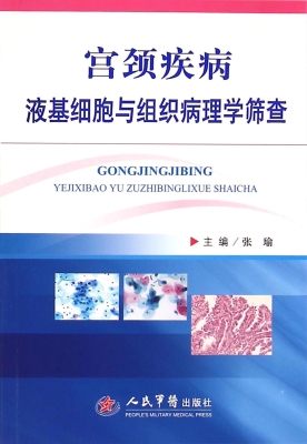 宫颈疾病液基细胞与组