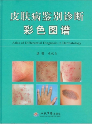 皮肤病鉴别诊断彩色图