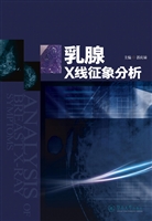 乳腺X线征象分析