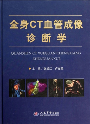 全身CT血管成像诊断学