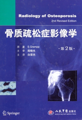 骨质疏松症影像学
