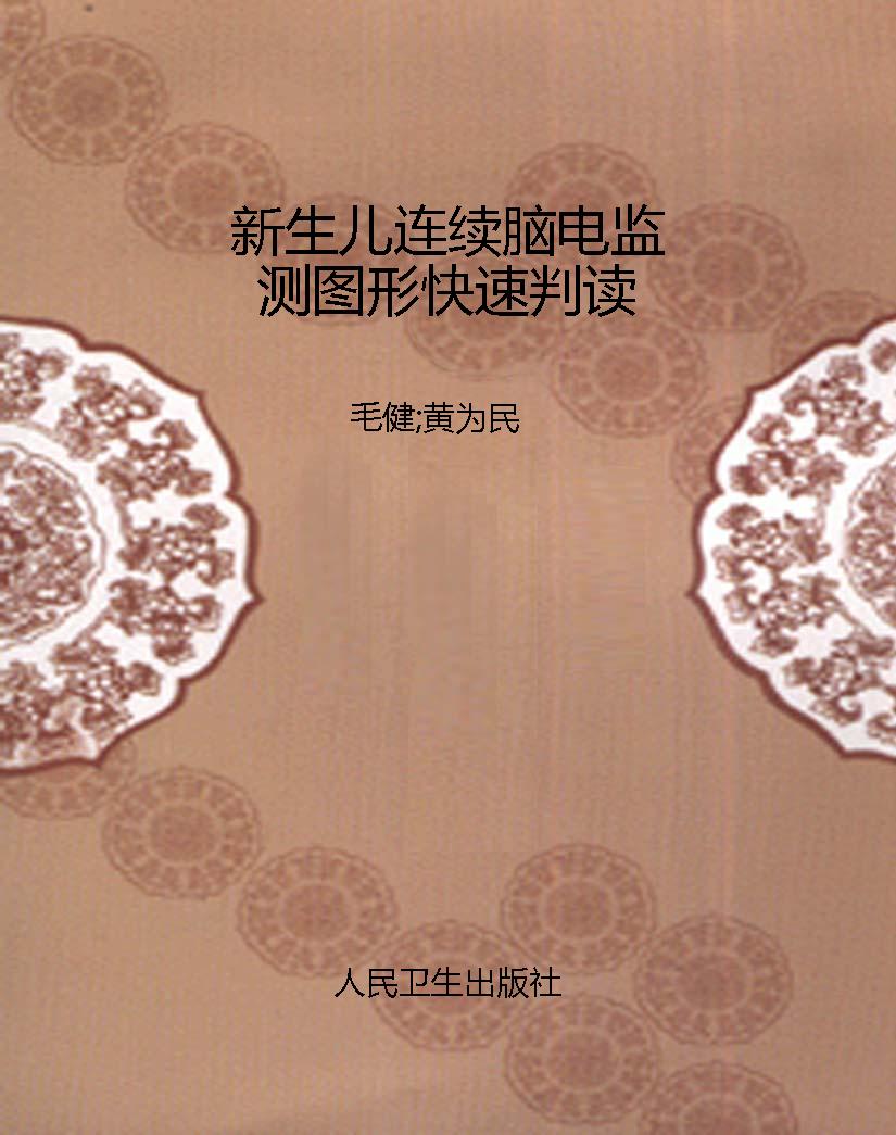 新生儿连续脑电监测图
