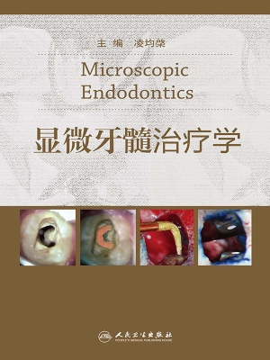显微牙髓治疗学