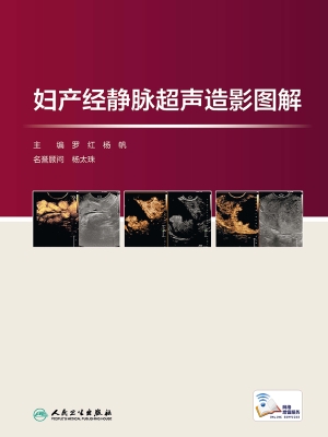 妇产经静脉超声造影图