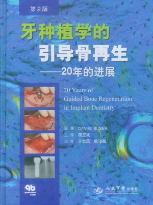 牙种植学的引导骨再生
