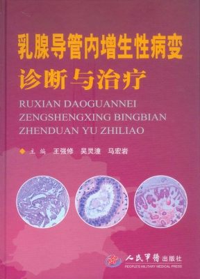 乳腺导管内增生性病变