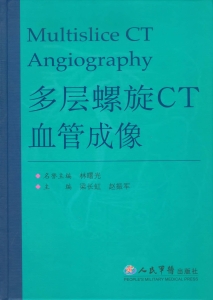 多层螺旋CT血管成像