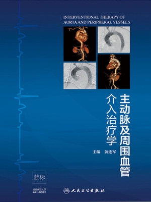 主动脉及周围血管介入