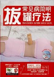 常见病简明拔罐疗法