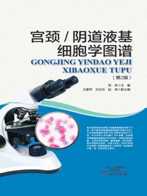 宫颈/阴道液基细胞学