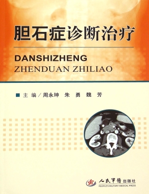 胆石症诊断治疗