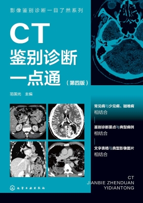 CT鉴别诊断一点通