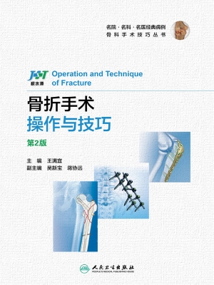 骨折手术操作与技巧