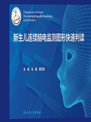 新生儿连续脑电监测图