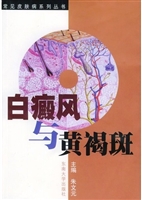白癜风与黄褐斑