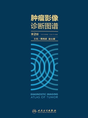 肿瘤影像诊断图谱
