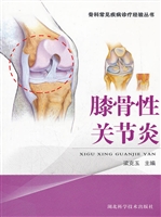 膝骨性关节炎