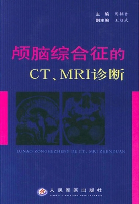 颅脑综合征的CT、MRI