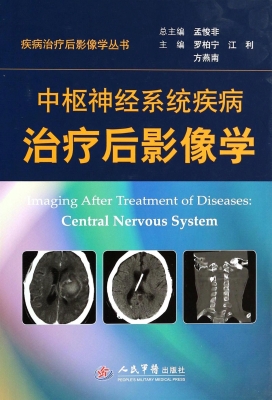 中枢神经系统疾病治疗