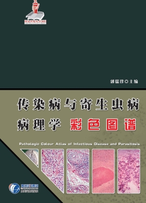 传染病与寄生虫病病理