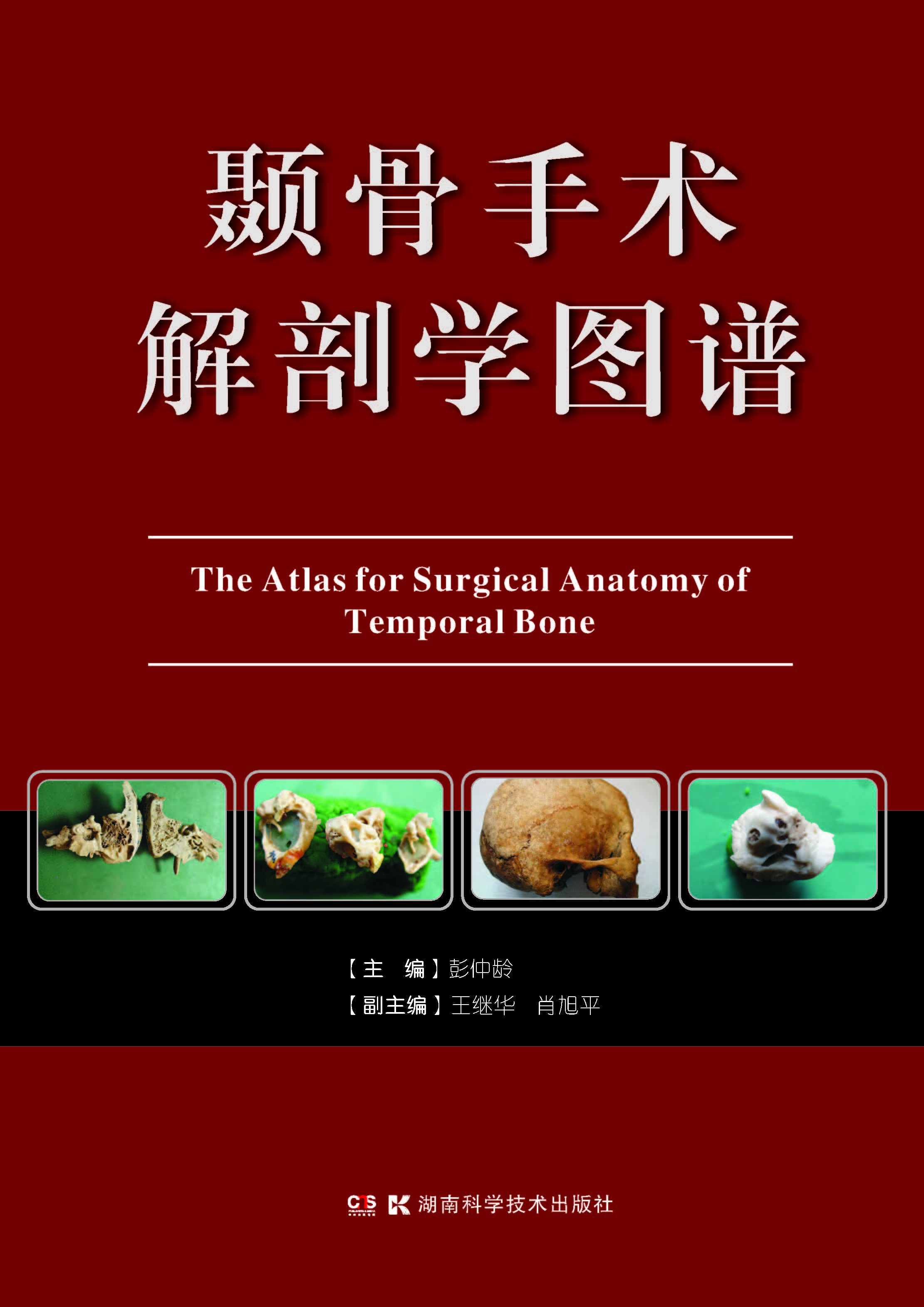 颞骨手术解剖学图谱