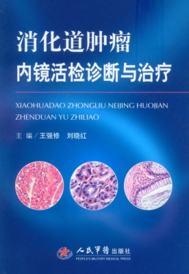 消化道肿瘤内镜活检诊