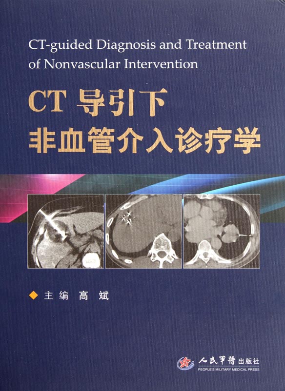 CT导引下非血管介入诊
