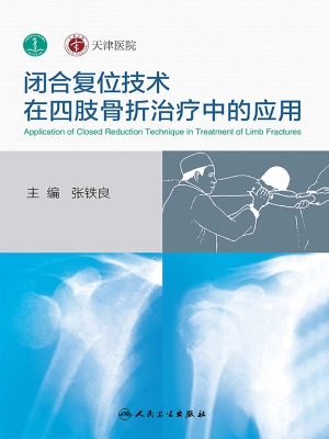 闭合复位技术在四肢骨