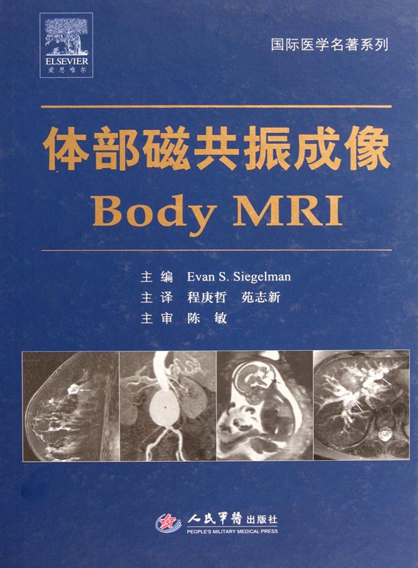 体部磁共振成像