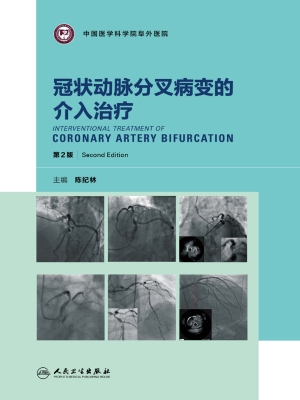冠状动脉分叉病变的介
