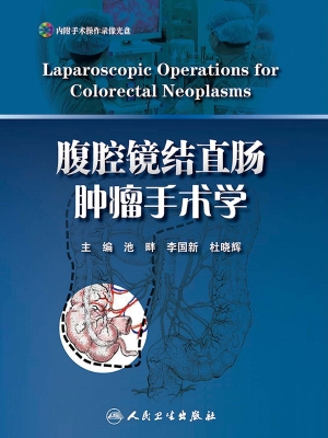 腹腔镜结直肠肿瘤手术
