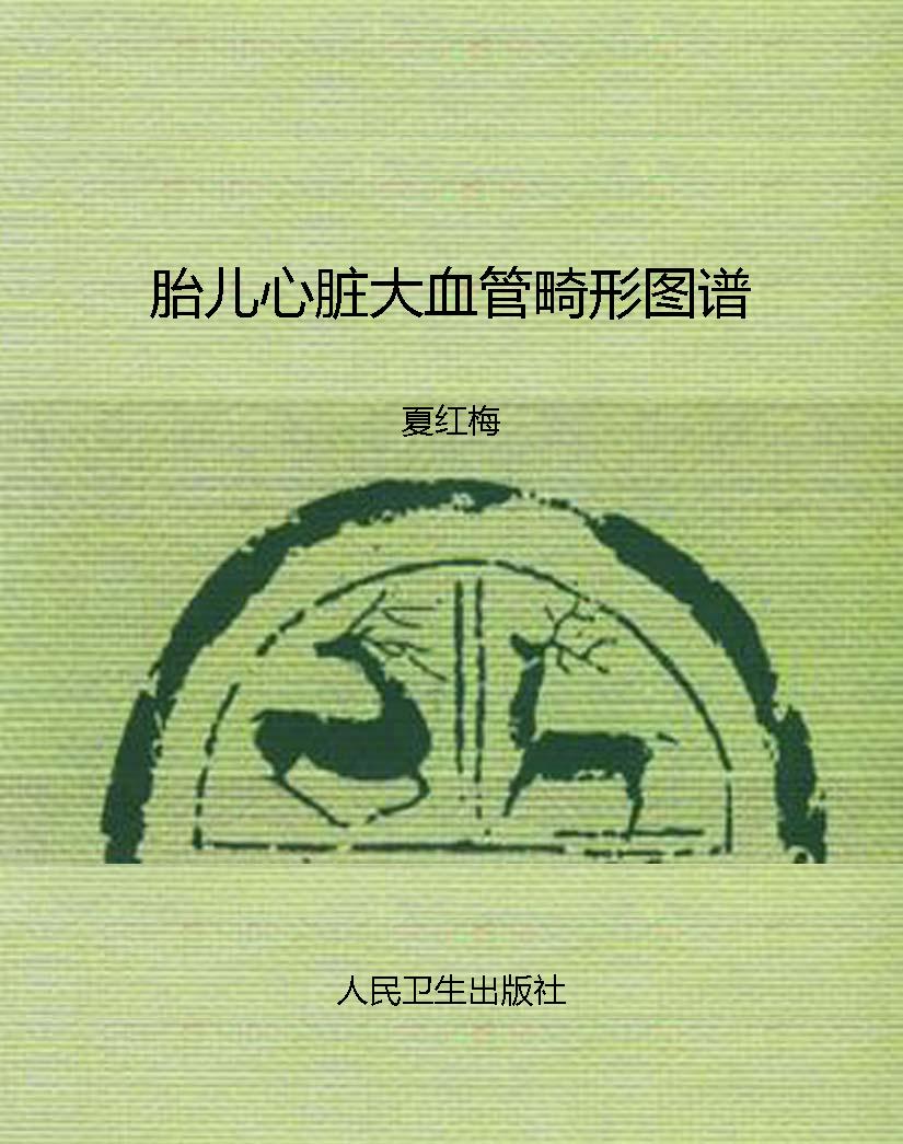 胎儿心脏大血管畸形图