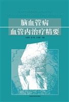 脑血管病血管内治疗精