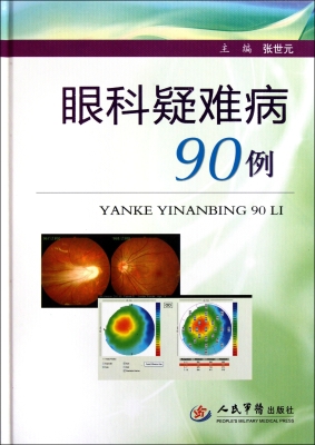 眼科疑难病90例