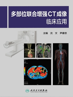 多部位联合增强CT成像