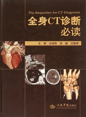 全身CT诊断必读