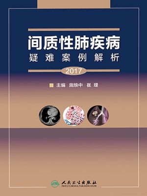 间质性肺疾病疑难案例