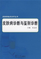 皮肤病诊断与鉴别诊断
