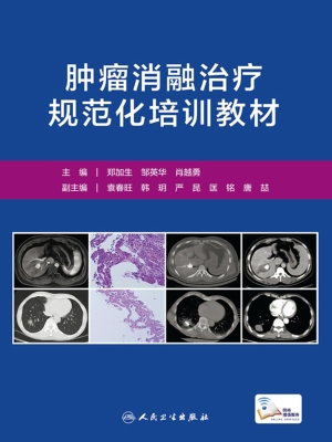 肿瘤消融治疗规范化培