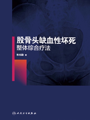 股骨头缺血性坏死整体