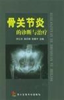 骨关节炎的诊断与治疗