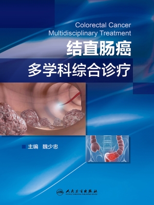 结直肠癌多学科综合诊