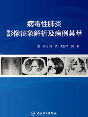 病毒性肺炎影像征象解