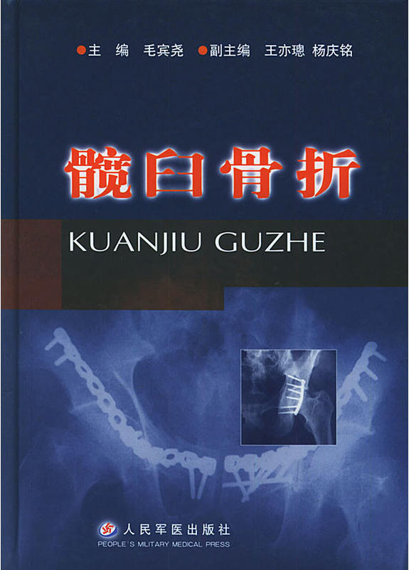 髋臼骨折